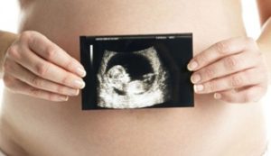 Lee más sobre el artículo Los legisladores de Ohio presentan un proyecto de ley para prohibir el aborto en el estado