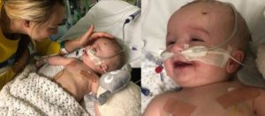 Lee más sobre el artículo ¡MILAGRO! Bebé despierta sonriendo a sus padres luego de estar 5 días en coma