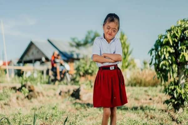 Lee más sobre el artículo Niña con síndrome de Apert comparte el Evangelio en su comunidad