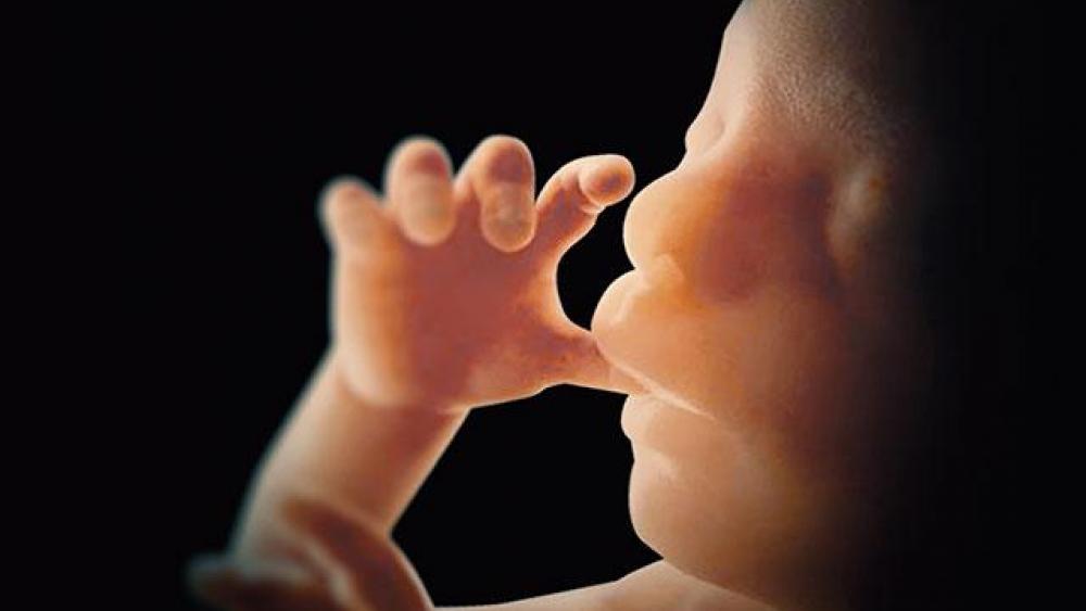 El fin del aborto en EE.UU. podría estar cerca con sorprendentes imágenes de bebés no nacidos en ultrasonido