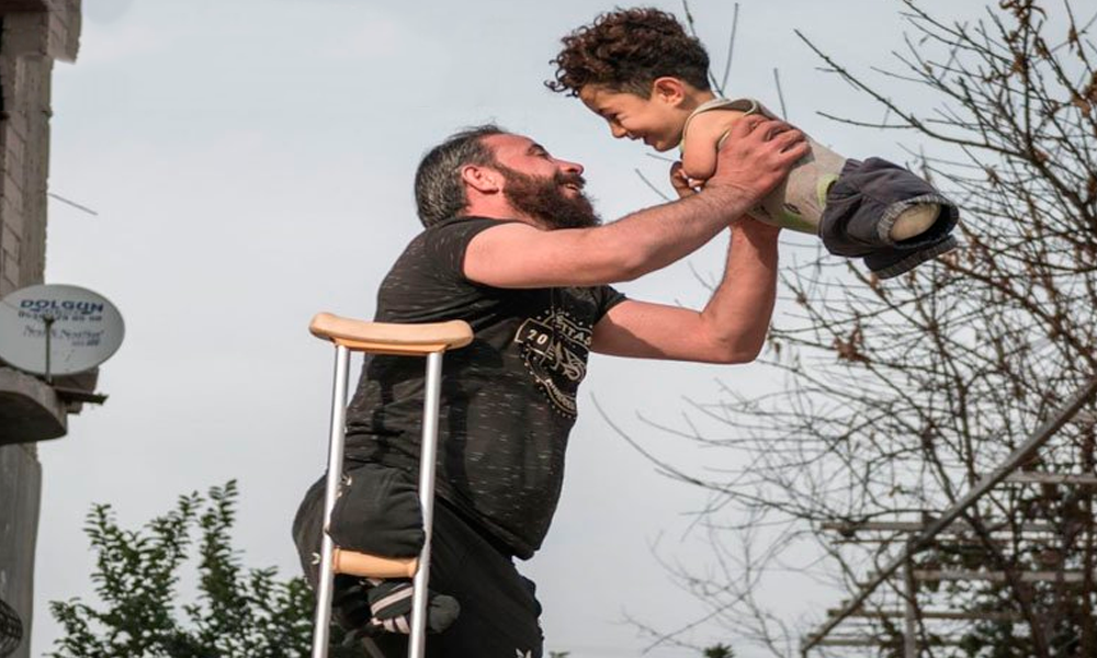 Padre e hijo recibirán prótesis gracias a la conmovedora fotografía viral que le dio la vuelta al mundo